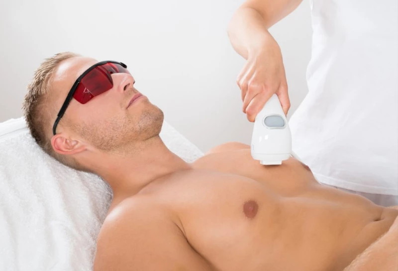 Epilation Laser - Bilan personnalisé