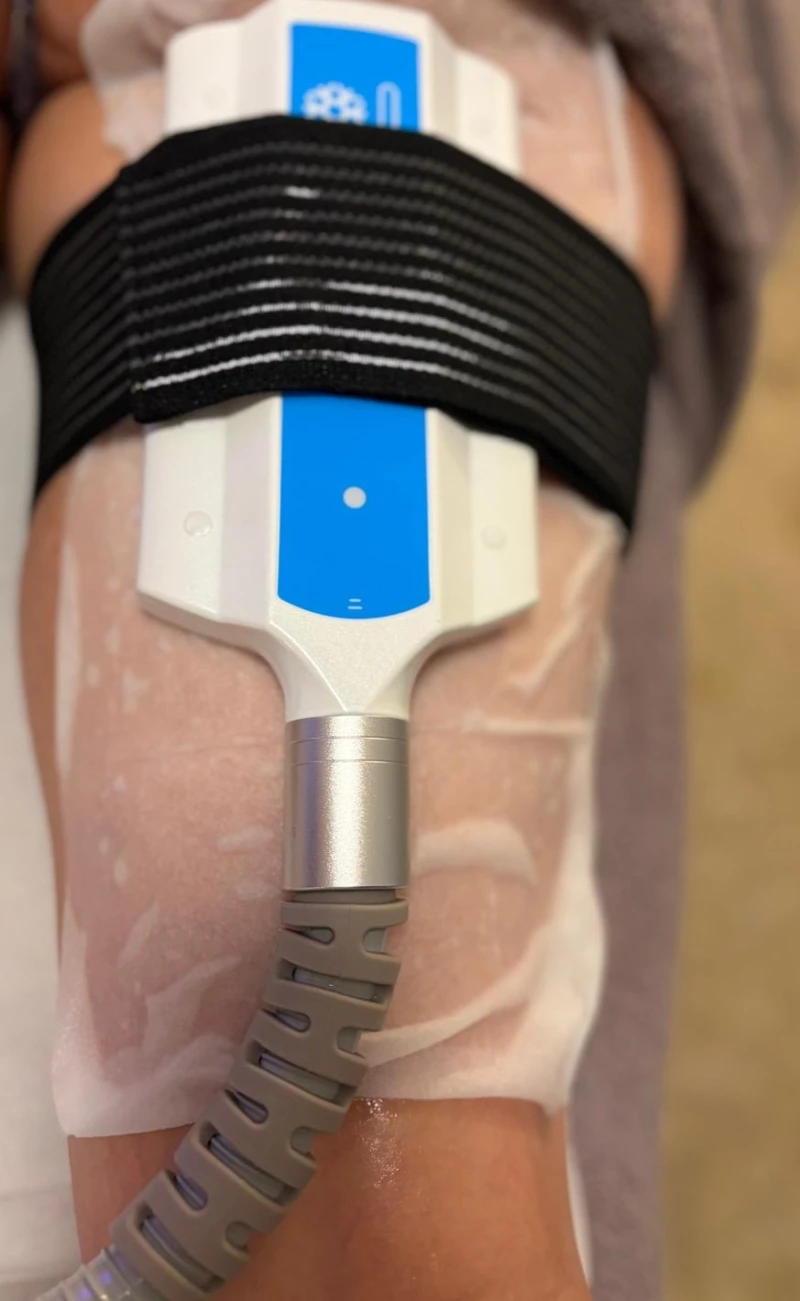 New ! Cryolipolyse 3in1 - Séance découverte